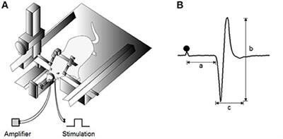 Unilateral Nasal Obstruction during Later Growth Periods Affects Craniofacial Muscles in Rats